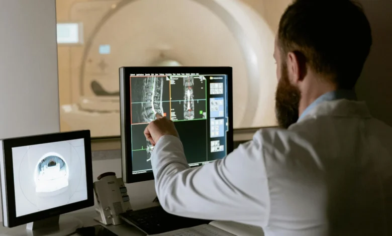 Illustration showing human nervous system affected by Motor Neurone Disease.
