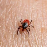 Tick on human skin symbolizing Lyme disease awareness in 2025