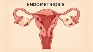 Woman experiencing pelvic pain representing endometriosis symptoms